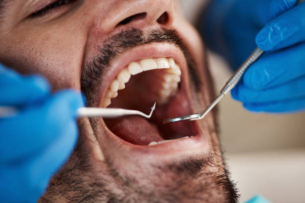 Best Knocked-Out Tooth Emergency  in Rock Rapids, IA